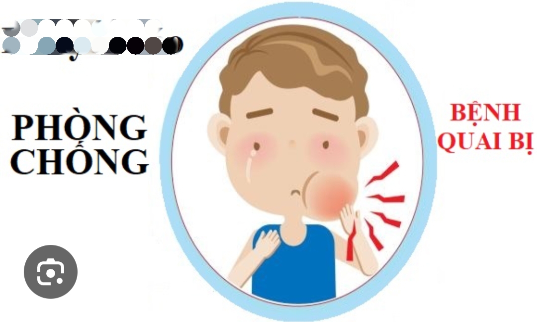 TUYÊN TRUYỀN PHÒNG CHỐNG BỆNH QUAI BỊ